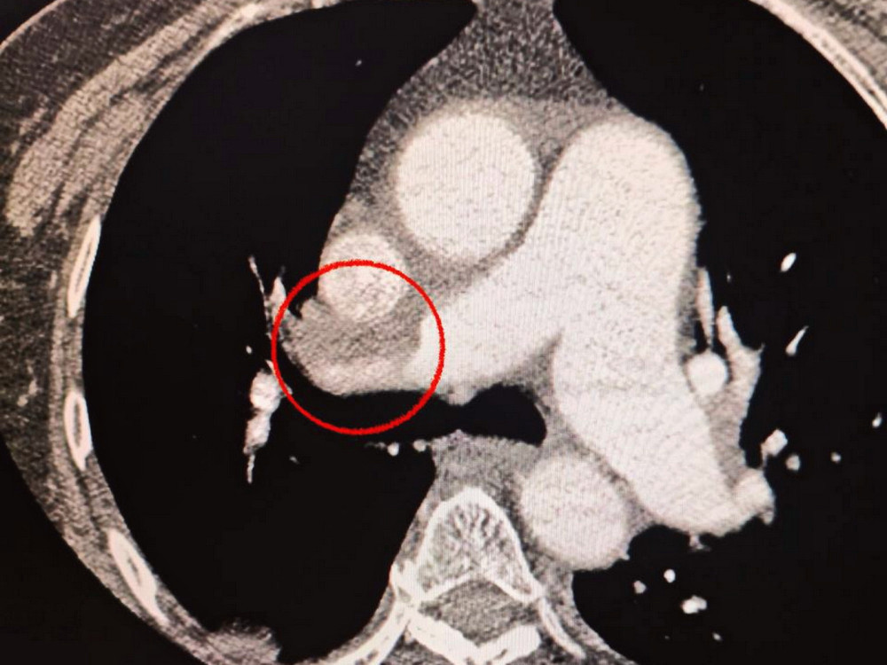 17408 image for slide